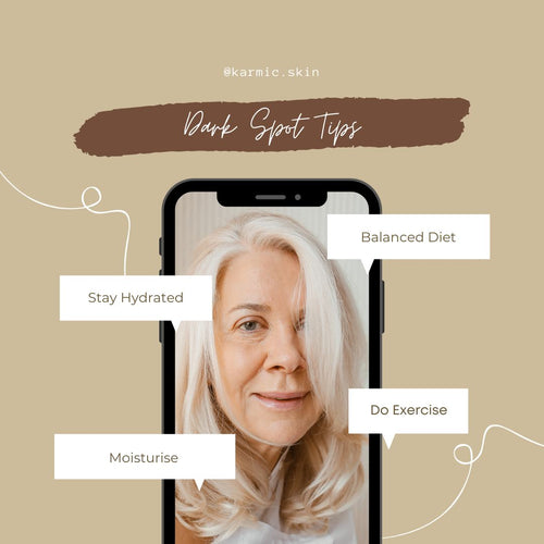 age spots causes