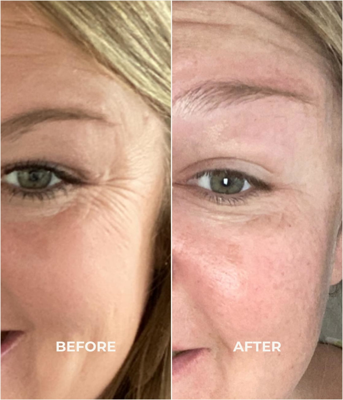 Before and After -anti wrinkle serum