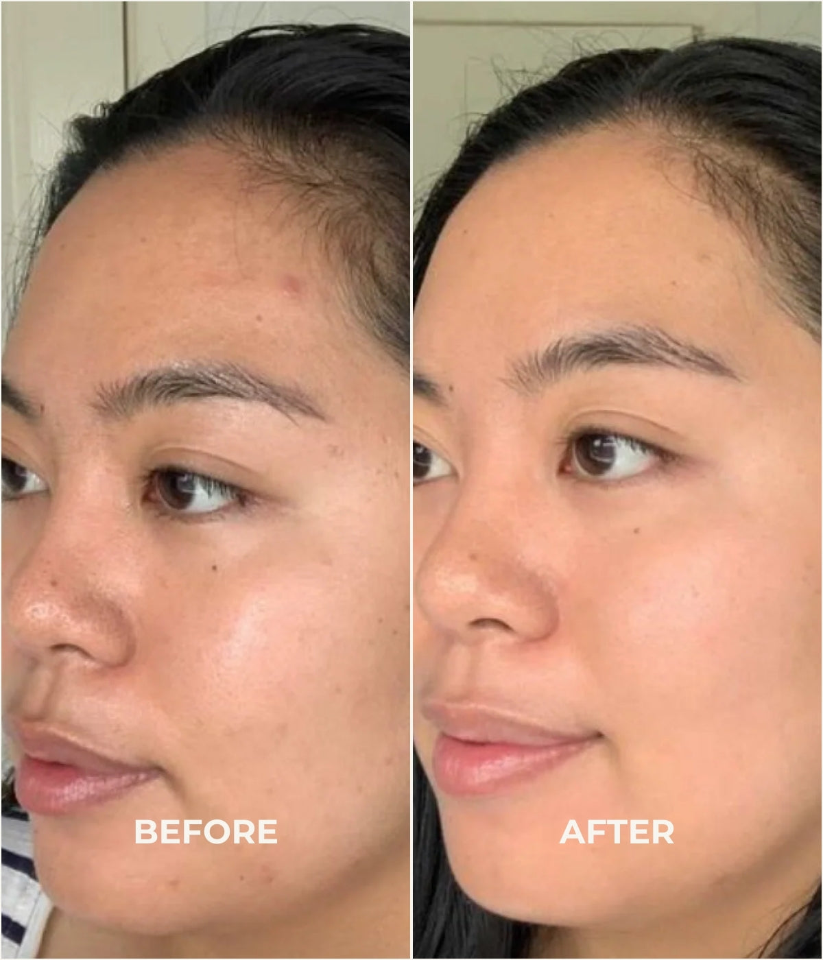 Before and After