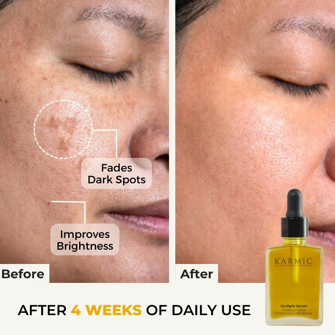 before and after use of anti wrinkle serum