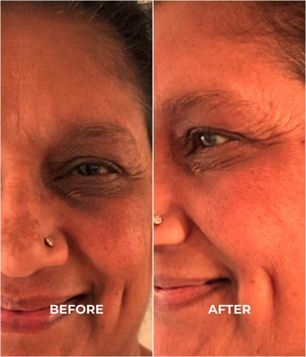 Before & after use of skin brightening serum