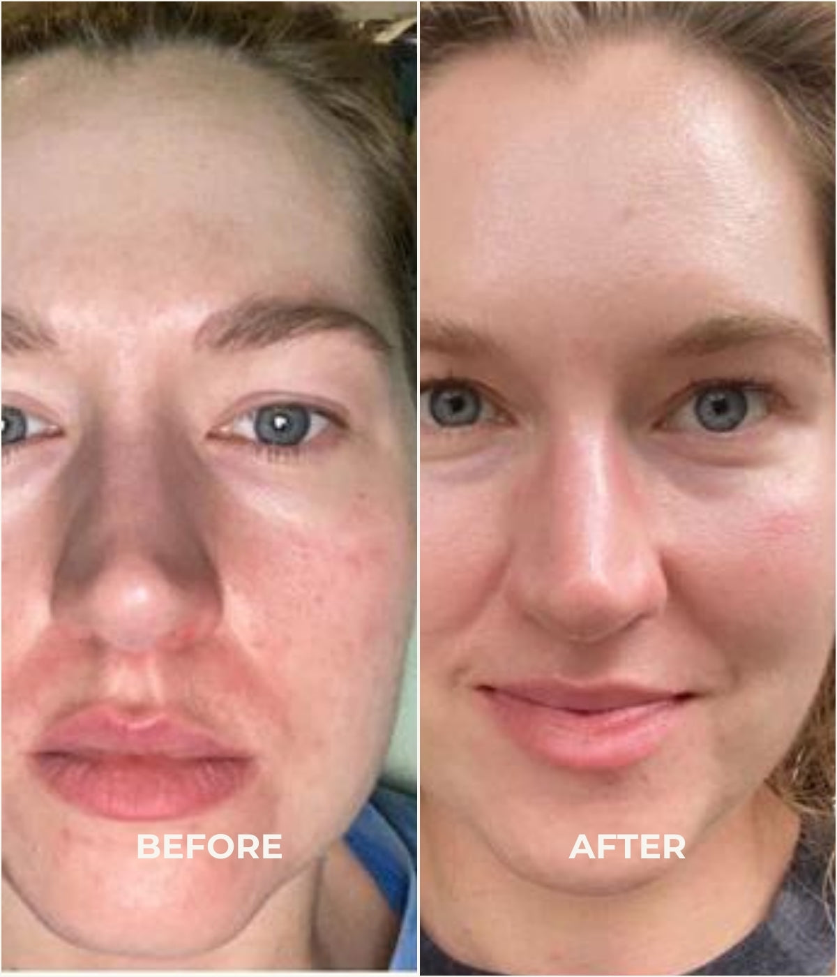 Before and after use of skin brightening serum