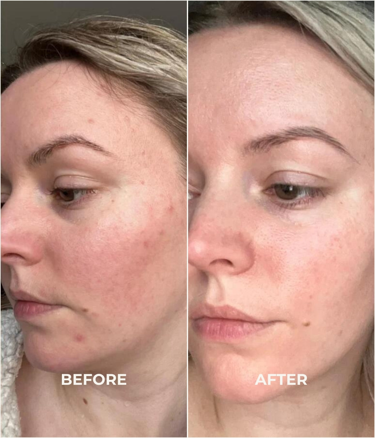 After use of the best anti ageing cream