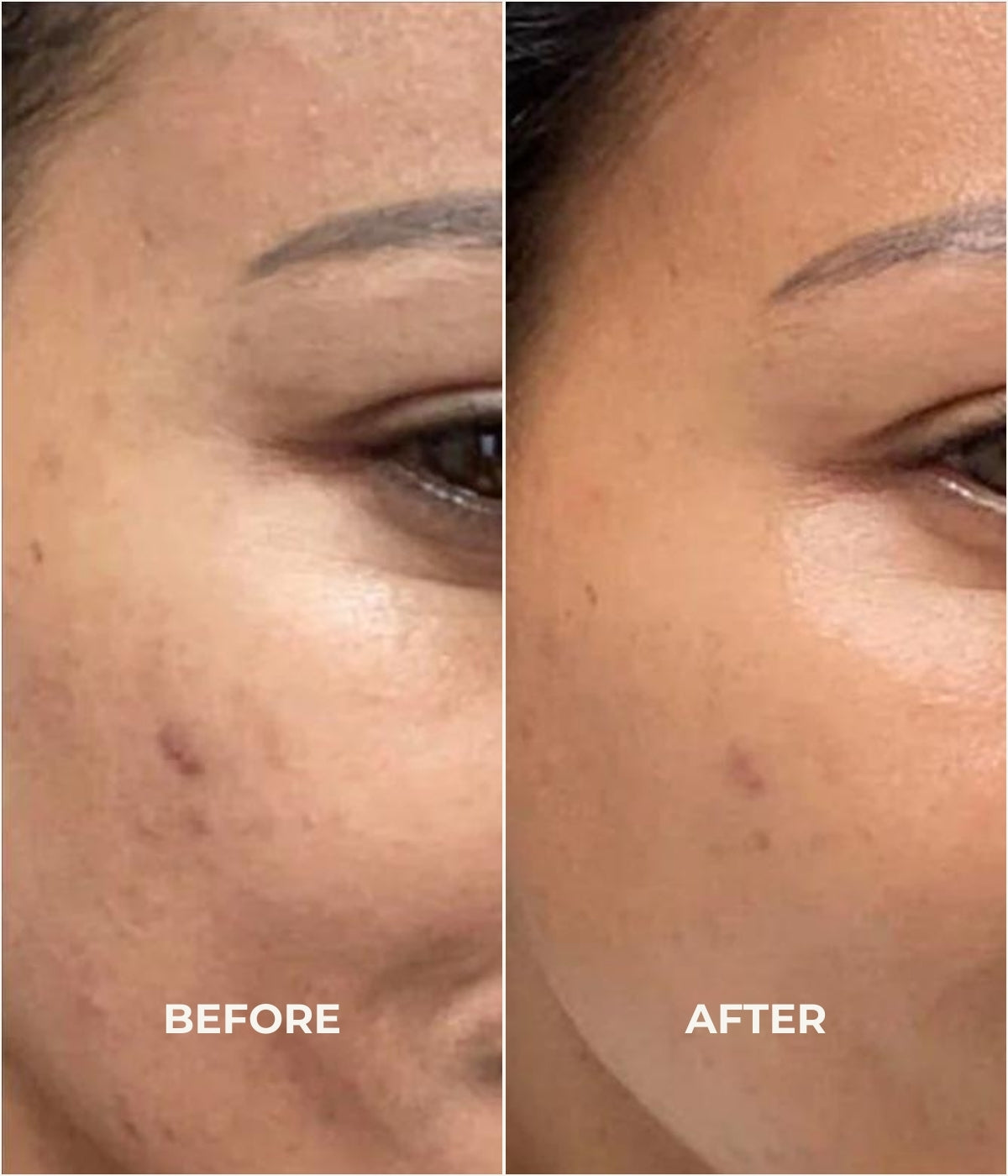 After use of the best anti ageing cream