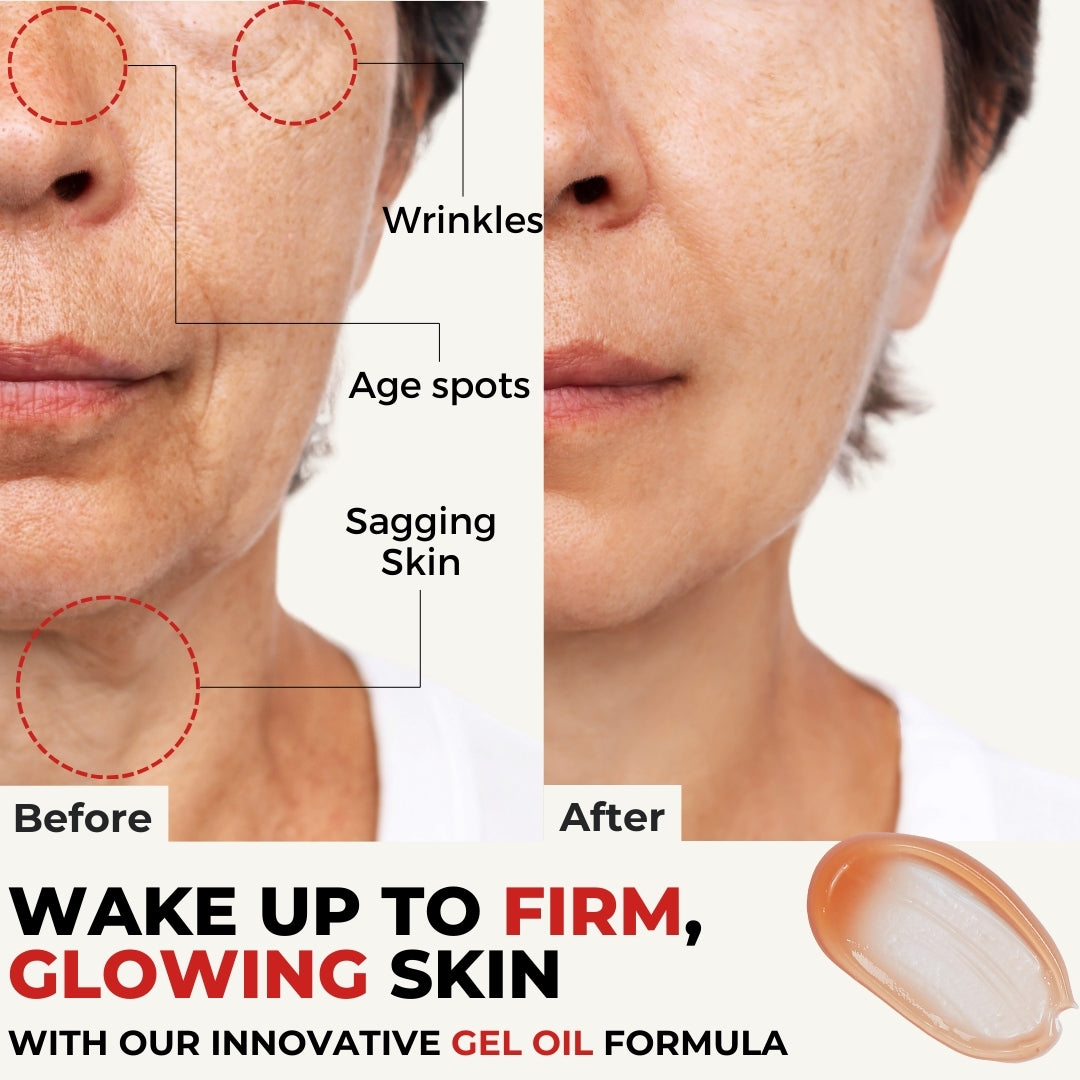 cream for wrinkles and dark spots