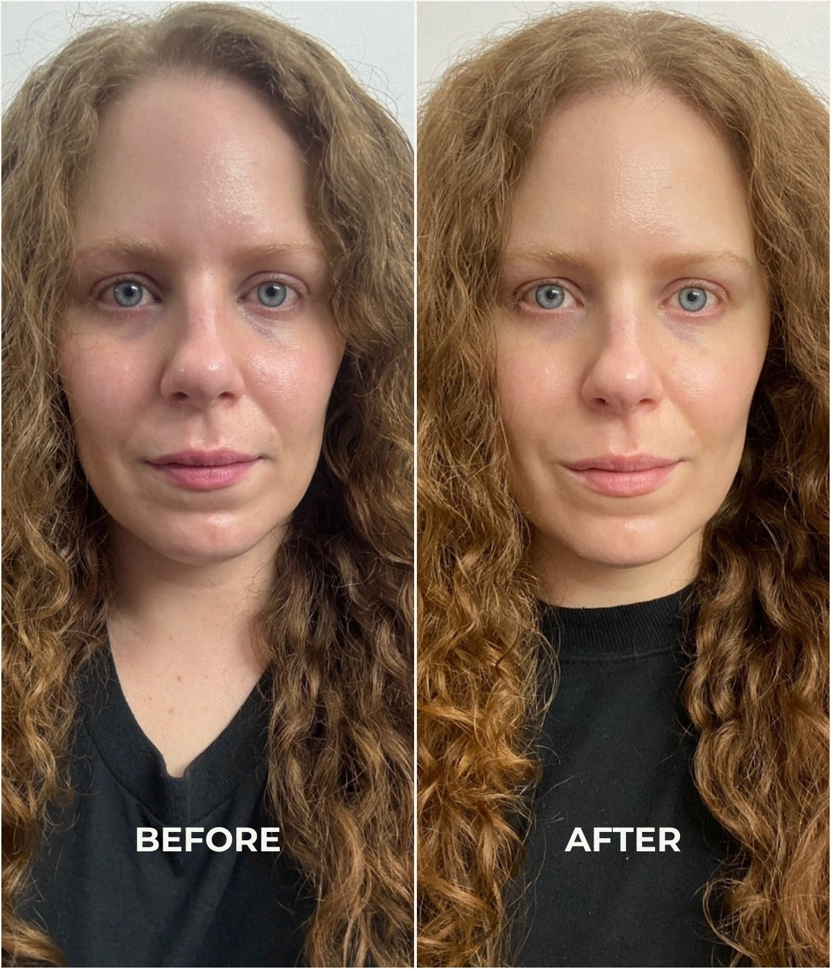 After use of skin brightening serum