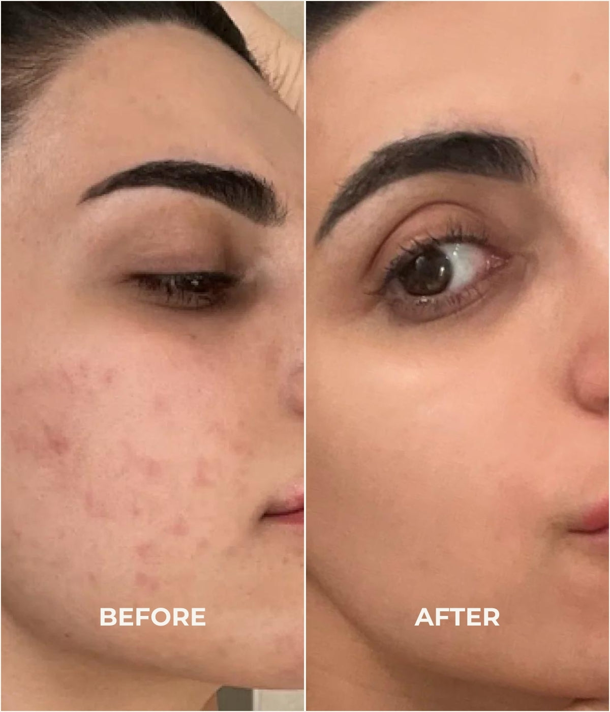 After use of the best anti ageing cream