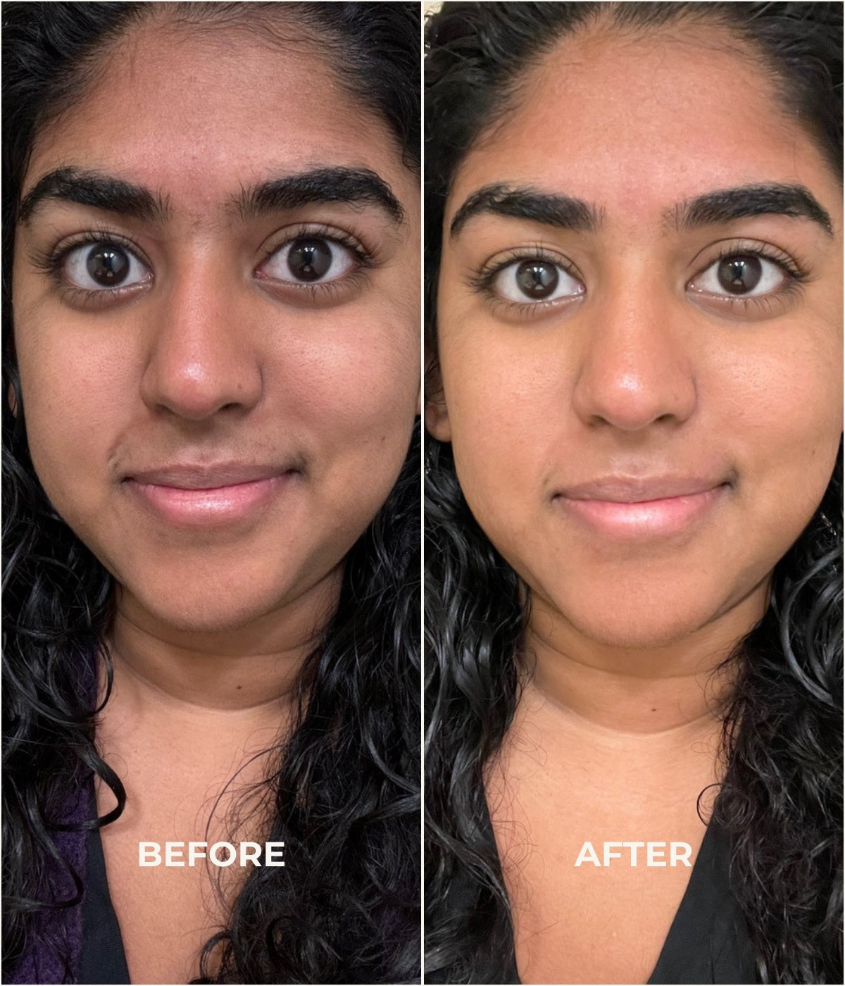 Before and after use of skin brightening serum
