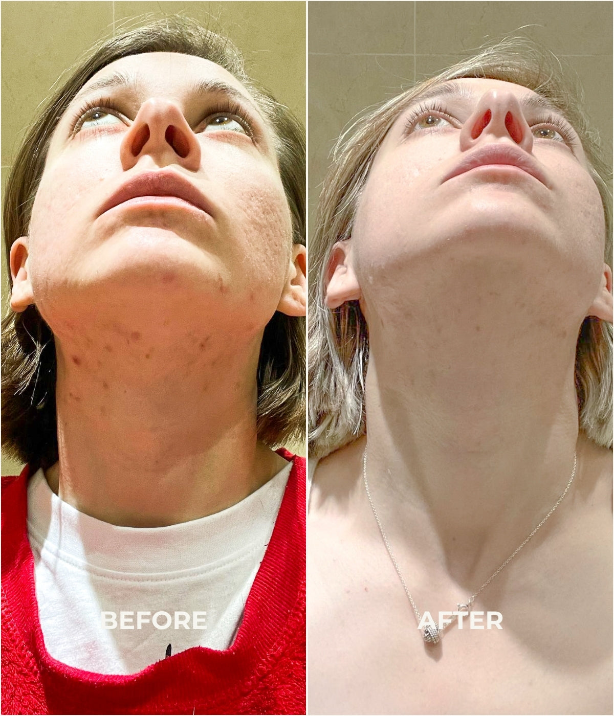 After use of the best anti ageing cream