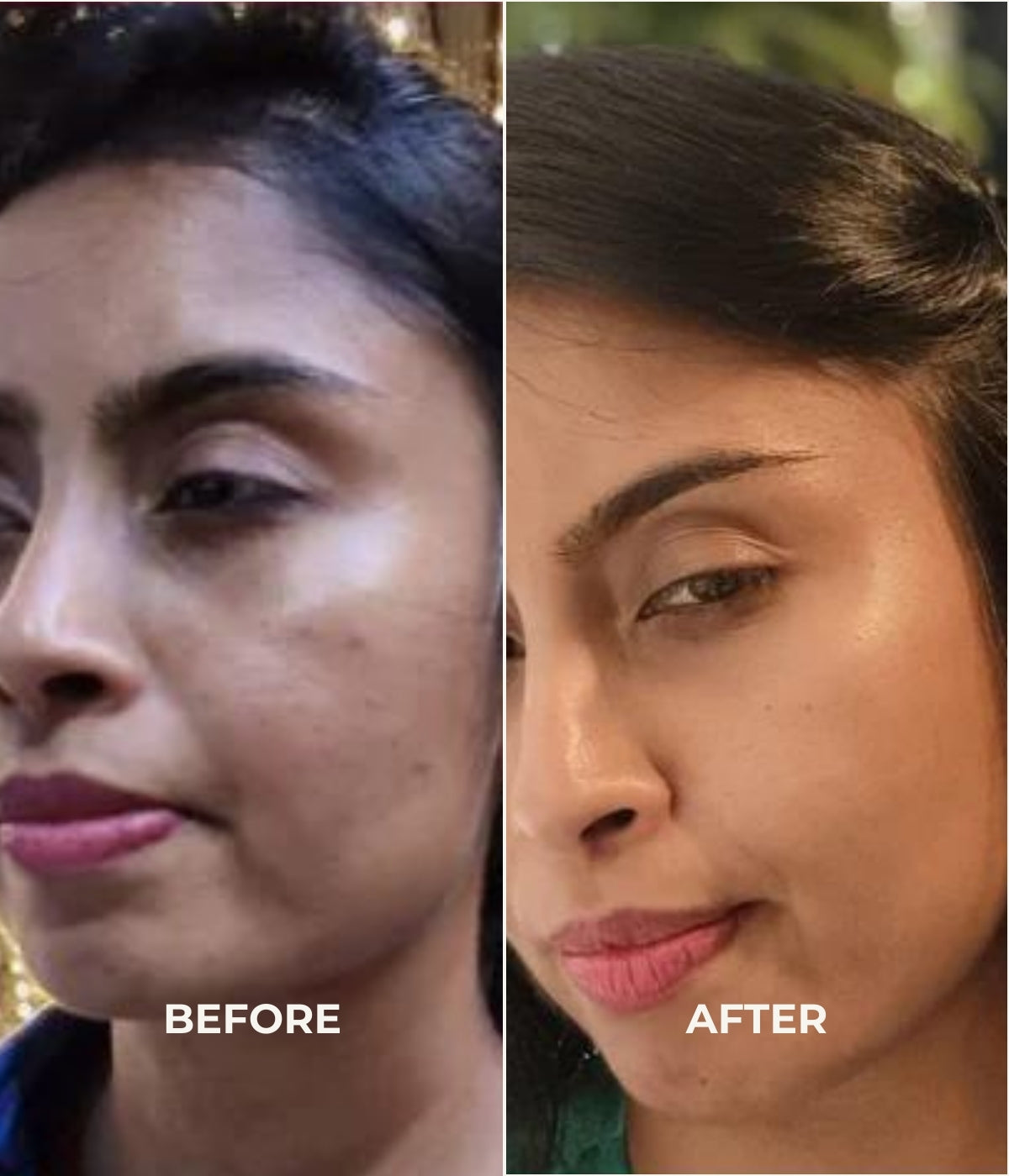 Before and After