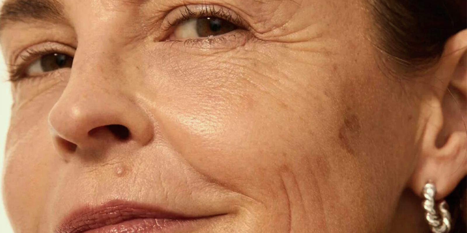skin inflammaging causing wrinkles and dark spots