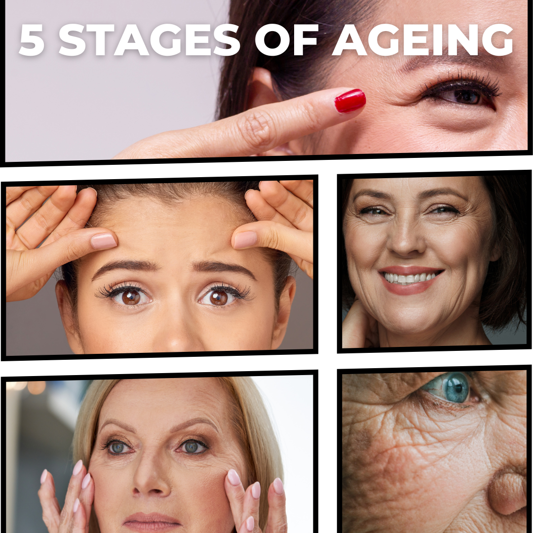 5 Stages of Ageing: From Fine Lines to Wrinkles